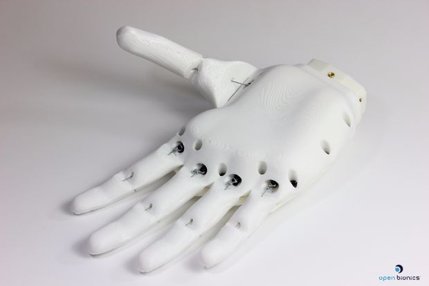 Open Bionics 3D printed prosthetic hand